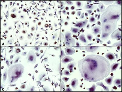 How osteogenic is dexamethasone?—effect of the corticosteroid on the osteogenesis, extracellular matrix, and secretion of osteoclastogenic factors of jaw periosteum-derived mesenchymal stem/stromal cells